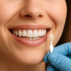 Estetica dentara - Clinica dentara Dr. Jakab Botoșani